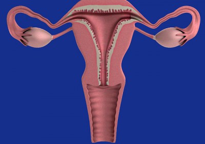 Syndrome des ovaires polykystiques : ce « mal invisible » qui touche 1 femme sur 5